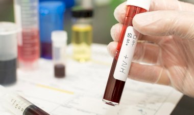 Diyanet İşleri Başkanının dikkat çektiği AIDS, eşcinsel lobilerin oyunlarını hatırlattı