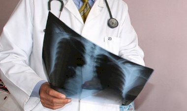 Tacikistan'da 319 kişi zatürre şüphesiyle tedavi görüyor