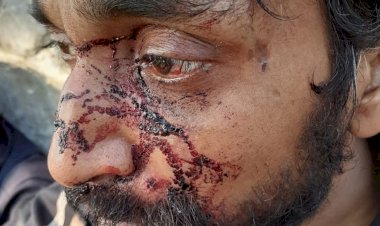 Uluslararası Af Örgütü, Hırvat polisinin sığınmacılara yönelik işkencelerine dikkati çekti