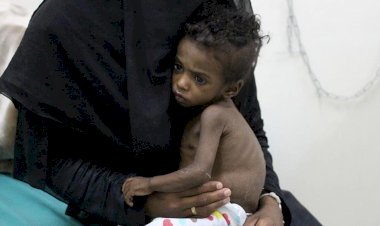 BM'den Yemen'de kıtlık uyarısı