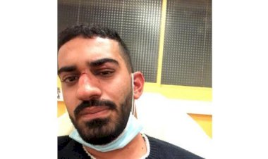 Fransa'da Ürdünlü iki kardeşe ırkçı şiddet: Burası Fransa niye Arapça konuşuyorsunuz