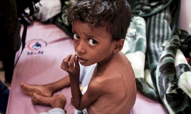 Husiler: ABD Yemen'deki savaşın uzamasının ve insani krizin derinleşmesinin müsebbibidir