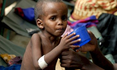 Nijerya'da yetersiz beslenme nedeniyle 81 çocuk yaşamını yitirdi