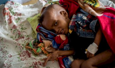 Etiyopya'nın Tigray bölgesinde 30 bin çocuk 'yüksek ölüm riski altında'