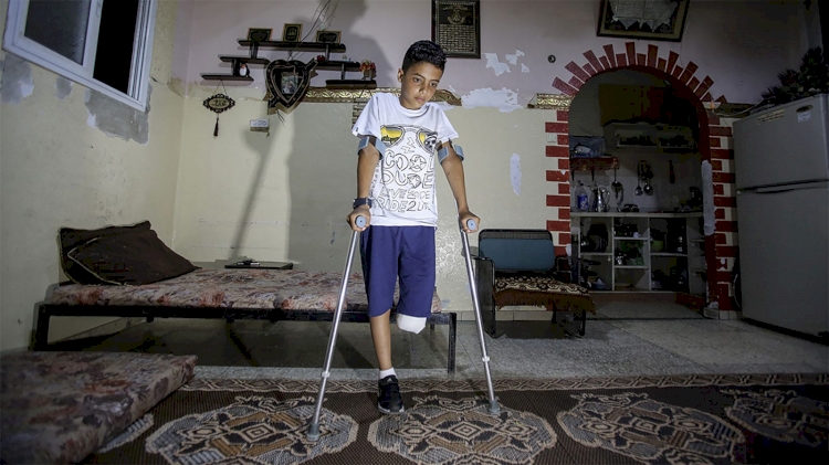 9 yaşındaki Hamdan: Yeni bir ayağımın olması hayali ile yaşıyorum
