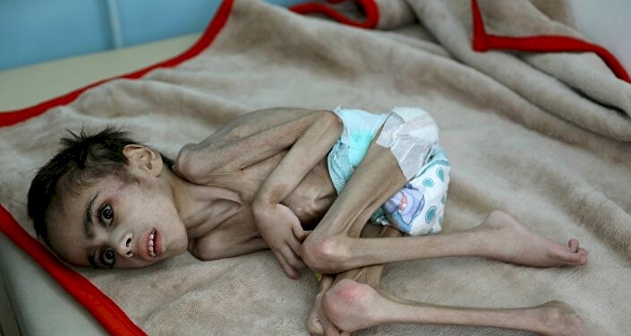 Yemen'de açlığın ve çaresizliğin fotoğrafı Faid Samim
