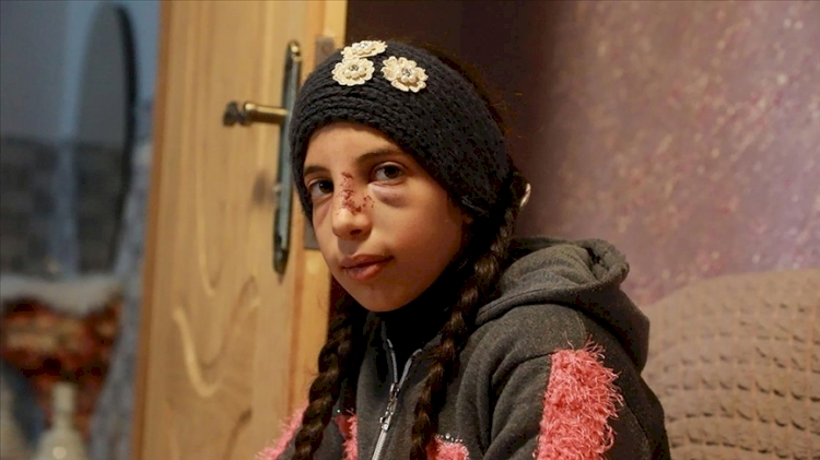 Siyonist yerleşimcilerin saldırısından zor kurtulan Filistinli küçük kız korku içinde yaşıyor