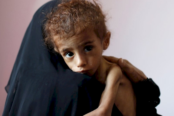 Yemen'de 400 bin çocuk bu yıl açlıktan ölme tehlikesiyle karşı karşıya