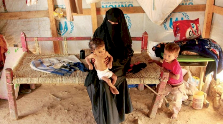 'Yemenli kadınlar, benzeri görülmemiş yaşam koşullarıyla mücadele ediyor'