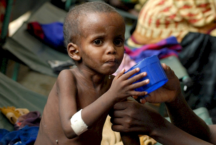 Nijerya'da yetersiz beslenme nedeniyle 81 çocuk yaşamını yitirdi