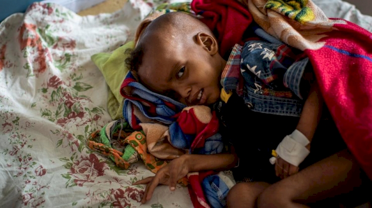Etiyopya'nın Tigray bölgesinde 30 bin çocuk 'yüksek ölüm riski altında'