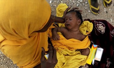 Dünya genelinde 35 milyon insan açlıktan ölüyor veya ölmek üzere