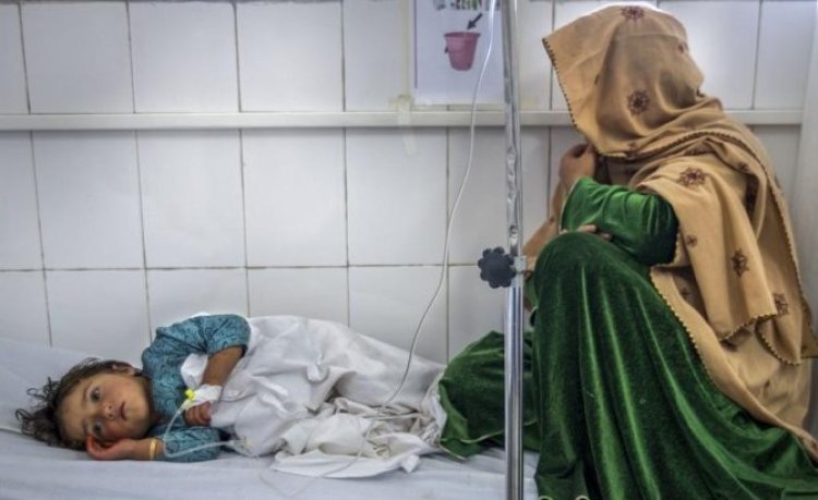 DSÖ: Afganistan'da 1 milyon çocuk akut yetersiz beslenme sebebiyle ölebilir