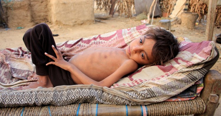UNICEF: Milyonlarca Yemenli açlığa sürükleniyor