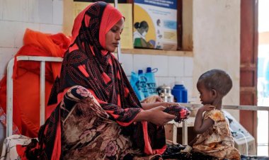 Somali'de beslenme merkezlerinde 700'den fazla çocuk hayatını kaybetti