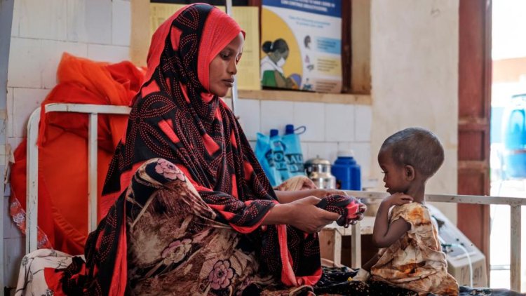 Somali'de beslenme merkezlerinde 700'den fazla çocuk hayatını kaybetti