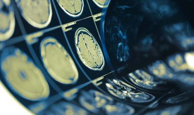 Bilim insanları beyindeki bağımlılık ağını haritalamayı başardı