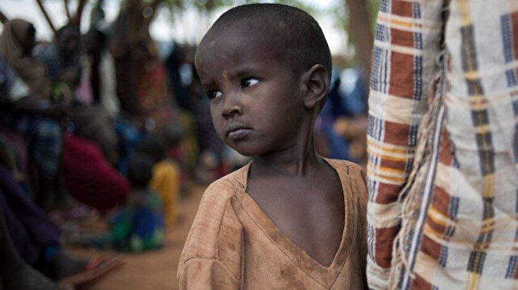 Somali'de çocuklar yetersiz beslenme nedeniyle ölüyor