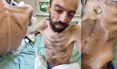 Avavide: Etim ve derim erise de direneceğim