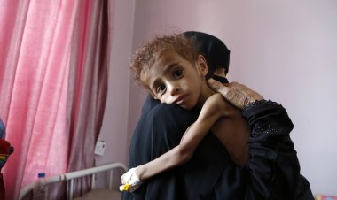 Yemen'de yarım milyon çocuğun hayatı yetersiz beslenme nedeniyle tehlikede