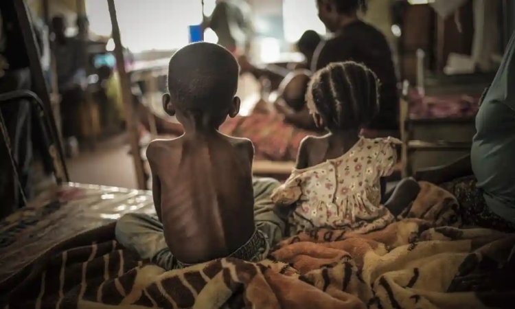 Kongo ve Etiyopya'da 50 milyondan fazla insan aç