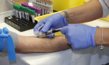 İngiltere’de denenen kan testiyle her üç kanserden ikisi tespit edildi