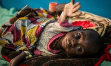 BM: Yıl sonuna kadar Mali'de 200 bin çocuk açlıktan ölebilir