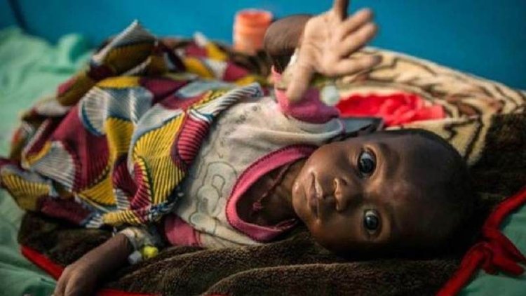 BM: Yıl sonuna kadar Mali'de 200 bin çocuk açlıktan ölebilir