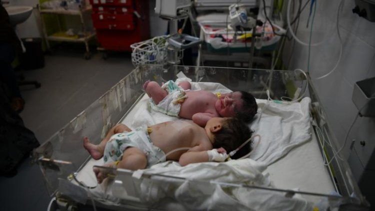 Gazze'de açlık nedeniyle sütü kesilen anneler bebeklerini besleyemiyor