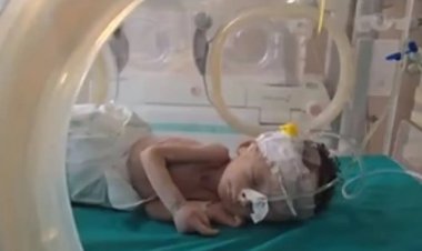 Gazze'deki Kemal Advan Hastanesi'nde bir hafta içinde 4 çocuk açlıktan hayatını kaybetti