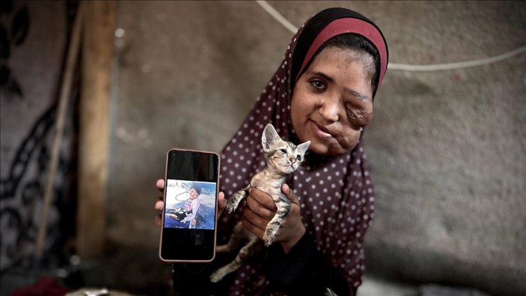 Filistinli kanser hastası kız çadırda yaşam mücadelesi veriyor
