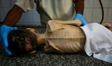 İşgalci İsrail saldırıları altındaki Gazze'de bir çocuk daha açlıktan öldü