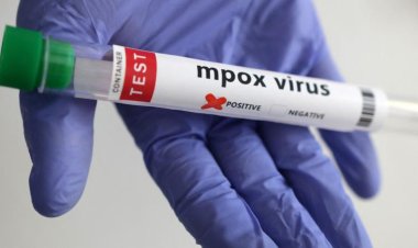 Dünya Sağlık Örgütü: M çiçeği salgını kontrol altına alınabilir ve durdurulabilir