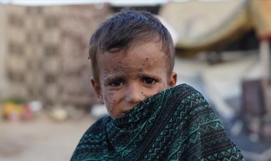 Gazze'de çocuklarda cilt hastalıkları vakaları artıyor