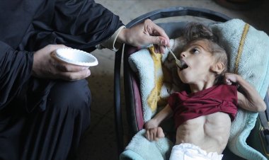 BM: Gazze'de 2.300’den fazla çocuk yetersiz beslenme tedavisi aldı