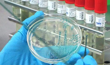 İngiltere'de bir koyunda ilk kuş gribi vakasına rastlandı