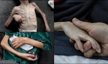 İşgalci İsrail ablukası: Gazzeli çocuklar açlıktan birer birer ölüyor