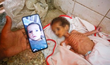 Soykırımcı İsrail, açlıktan ölen çocuklara rağmen kıtlık olmadığını iddia ediyor