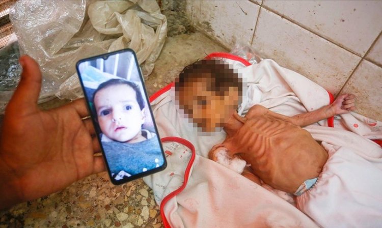 İsrail ablukası altındaki Gazze'de 3 aylık bebek Curi de açlıktan hayatını kaybetti