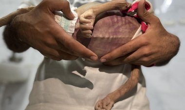 Gazze'de açlıktan hayatını kaybedenlerin sayısı 127'ye yükseldi