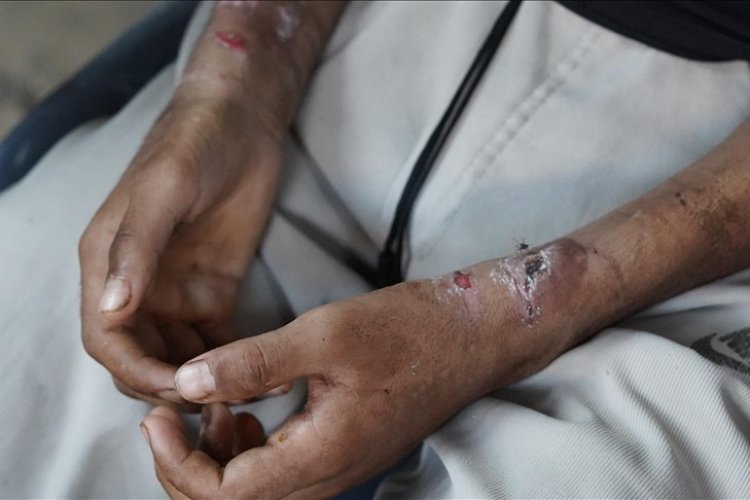 İsrailli sağlık çalışanı ve askerlerden Filistinli mahkumlara işkence itirafı