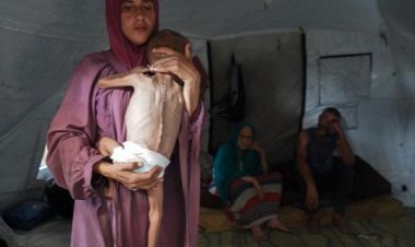 BM: Gazze'de çocuklar arasında akut yetersiz beslenme en yüksek seviyede