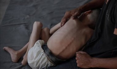 Son 24 saatte Gazze’de açlıktan 11 kişi daha şehid oldu