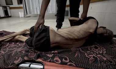 BM: Gazze'de açlıktan ölen insan haberleri sıradan bir olay haline geldi