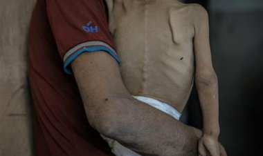 Gazze'de açlıktan ölenlerin sayısı son 24 saatte 3 artarak 269'a çıktı