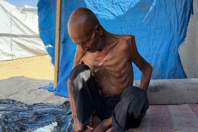 Gazze'de yaşlı adam, İsrail'in dayattığı açlık nedeniyle 40 kiloya düştü