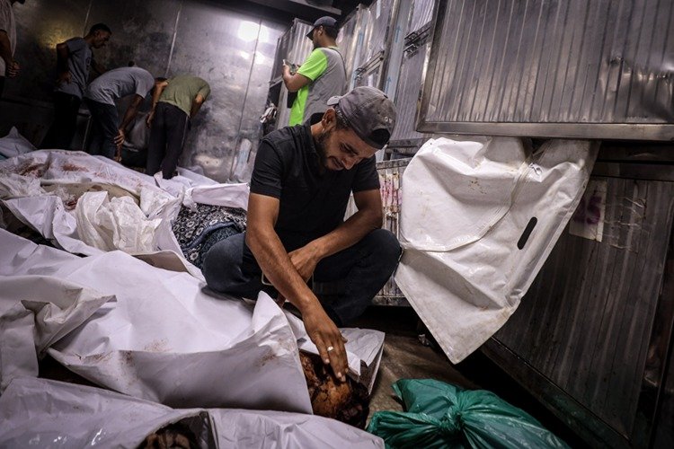 Gazze Şeridi'nde son 24 saatte biri çocuk 8 kişi daha açlıktan hayatını kaybetti