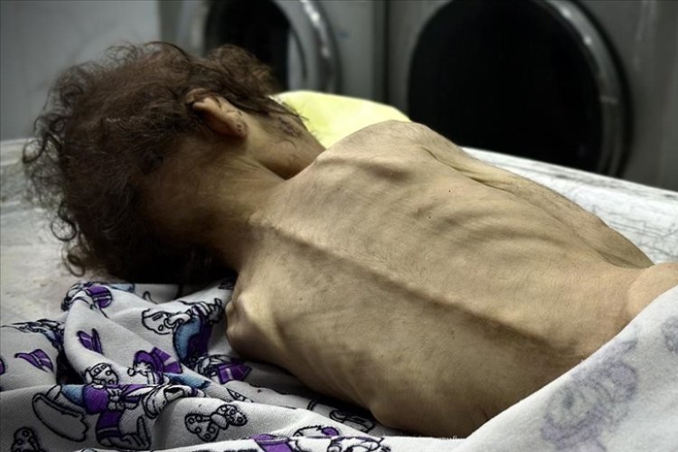 Gazze Şeridi'nde son 24 saatte 2’si çocuk 4 kişi daha açlıktan hayatını kaybetti