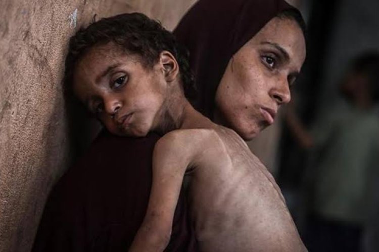 Gazze'de açlık felaketi: 106'sı çocuk 235 şehit