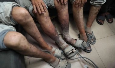 Katil İsral'in işkence ettiği Gazzeli 10 esir serbest bırakıldı